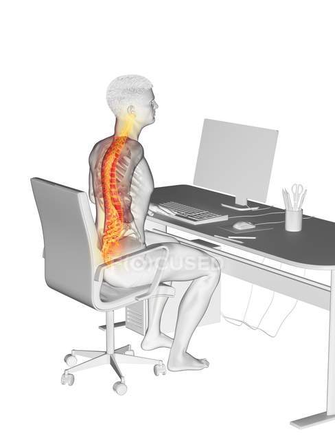 Büroangestellte Silhouette, die mit Rückenschmerzen am Schreibtisch sitzt, konzeptionelle Illustration. — Stockfoto