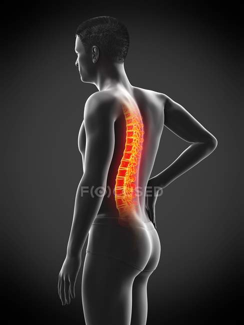 Vista lateral del cuerpo masculino con dolor de espalda sobre fondo negro, ilustración conceptual
. — Stock Photo