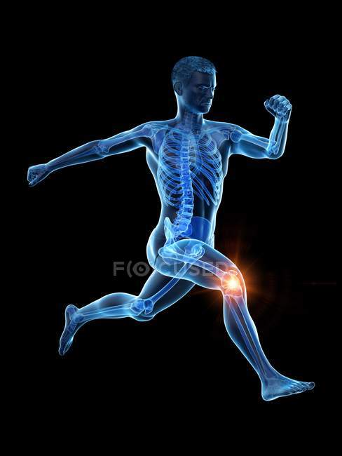 Силуэт бегуна с болью в колене, цифровая иллюстрация
. — стоковое фото