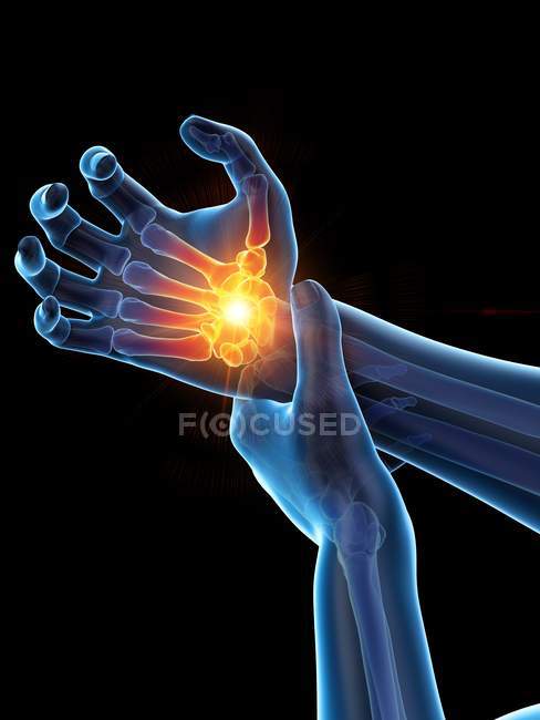 Male hands with glowing wrist pain, conceptual illustration. — Stock Photo