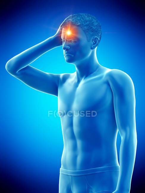 Homme avec maux de tête, illustration médicale conceptuelle
. — Photo de stock