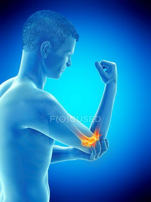 Corpo masculino abstrato com dor visível no cotovelo, ilustração conceitual . — Fotografia de Stock