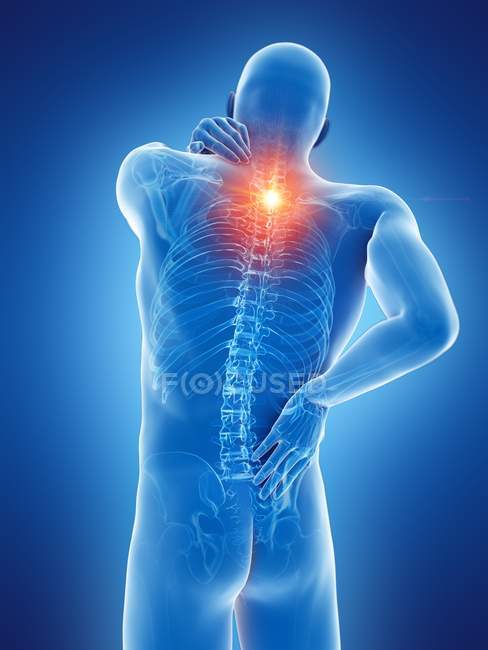 Cuerpo masculino con dolor de espalda sobre fondo azul, ilustración digital . - foto de stock