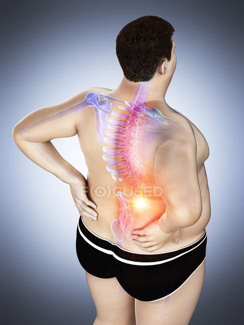 Corpo masculino obeso com dor nas costas em visão de alto ângulo, ilustração digital
. — Fotografia de Stock