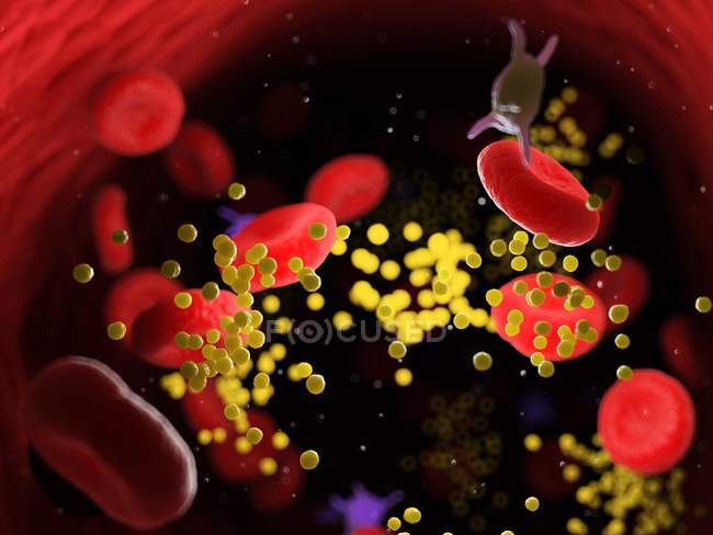 Grasa en las células sanguíneas que bloquean los vasos sanguíneos, ilustración digital
. - foto de stock