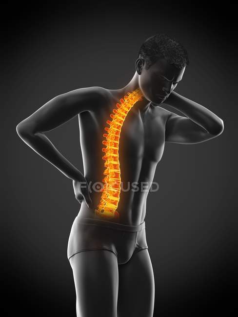 Згинання чоловічого тіла з болем у спині, концептуальна ілюстрація . — стокове фото