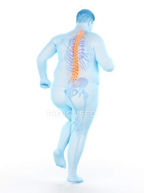 Corpo corridore maschile obeso con mal di schiena, illustrazione concettuale . — Foto stock