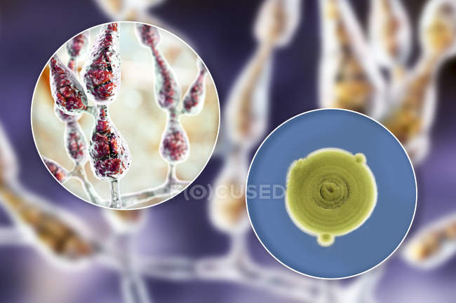 Digital illustration of fungal morphology of filamentous allergenic fungus Alternaria alternata and photograph of fungal colonies on Sabouraud Dextrose Agar. — Stock Photo