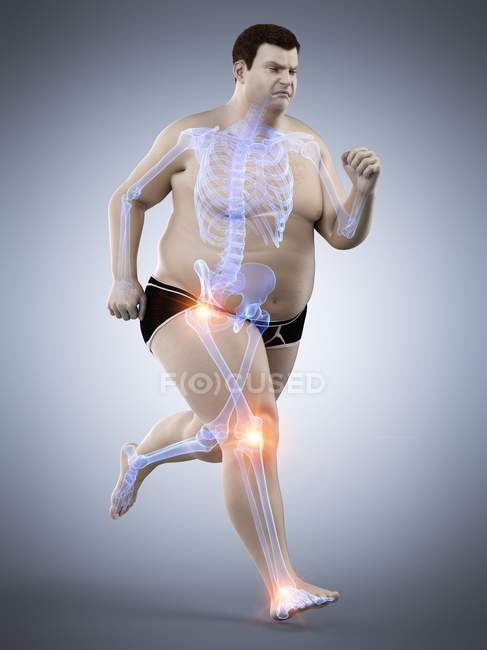 Silhueta de homem obeso correndo com dor nas articulações, ilustração do computador . — Fotografia de Stock