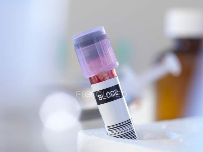 Образец крови в ожидании лабораторных испытаний, крупным планом с выборочным фокусом. — стоковое фото