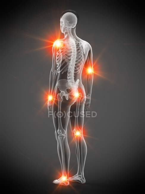 Corpo humano com pontos de dor articular, ilustração conceitual . — Fotografia de Stock