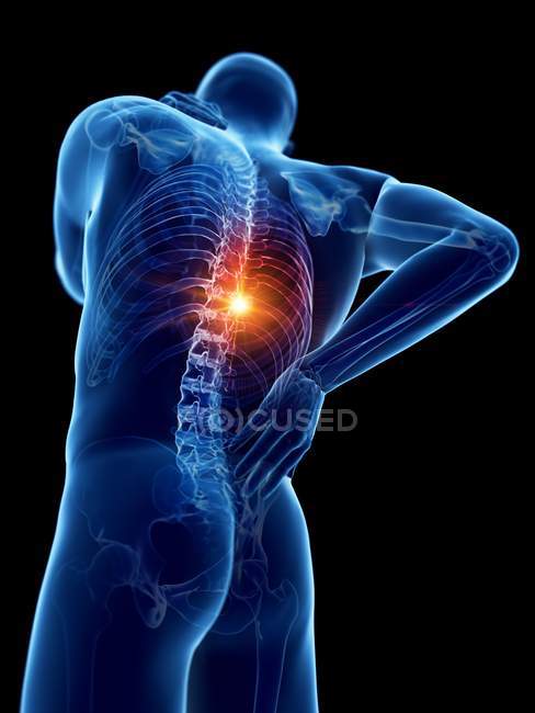 Silueta de cuerpo masculino con dolor de espalda, ilustración digital
. - foto de stock
