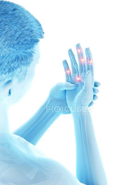 Abstract man having finger pain, conceptual illustration. — Stock Photo