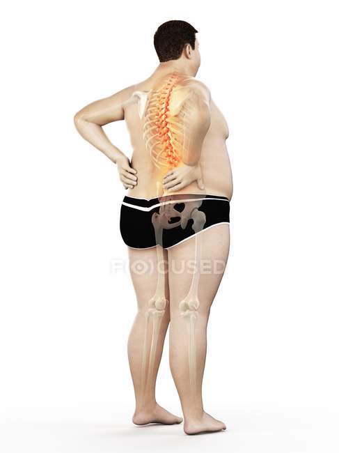 Obese male full length silhouette with back pain, digital illustration. — Stock Photo