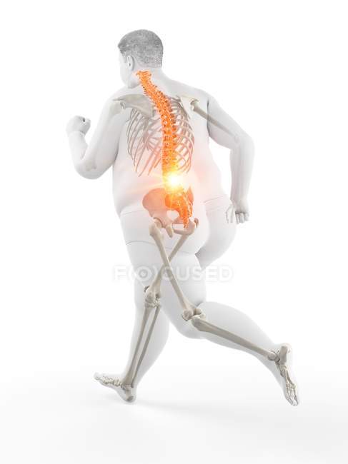 Obeso corpo corredor masculino com dor nas costas, ilustração conceitual . — Fotografia de Stock