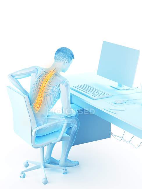 Trabajador de oficina masculino con dolor de espalda debido a sentado, ilustración conceptual . - foto de stock