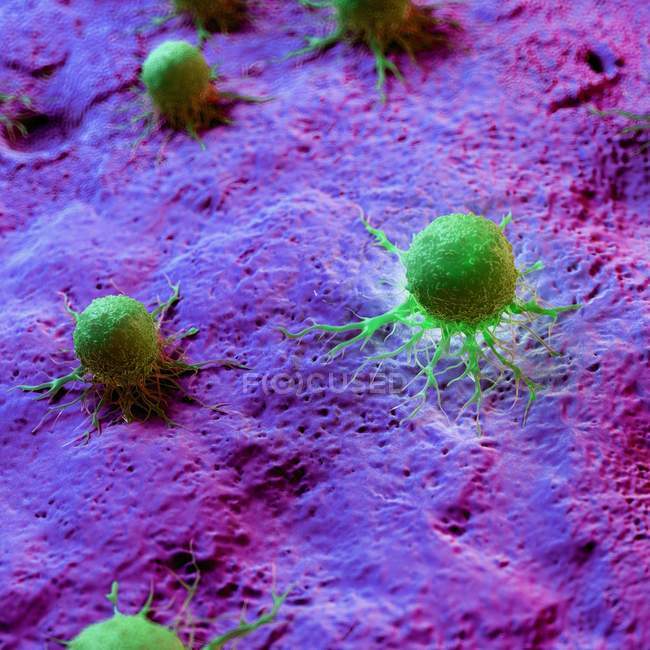 Cellule tumorali astratte di colore verde su tessuto, illustrazione digitale
. — Foto stock
