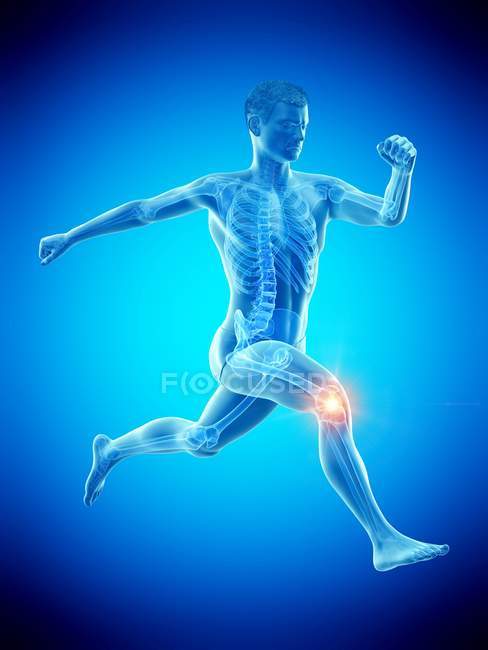 Silueta de corredor con dolor de rodilla, ilustración digital . - foto de stock