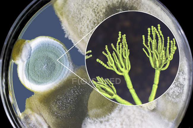 Колонії Penicillium fungi вирощені на Sabouraud Dextrose Agar і цифрові ілюстрації грибної морфології. — стокове фото