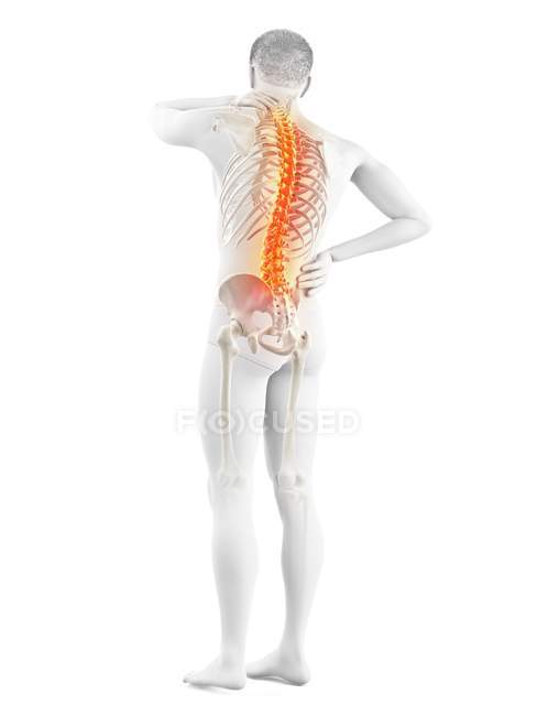 Corpo maschile con mal di schiena nella vista posteriore, illustrazione concettuale . — Foto stock