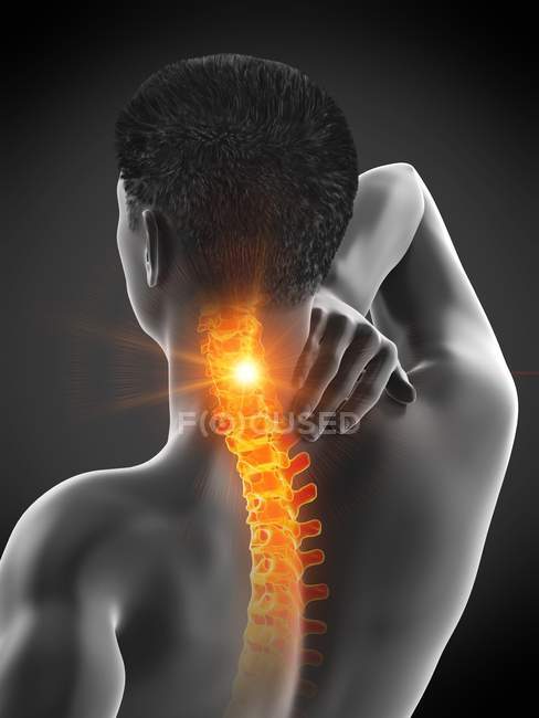 Corpo masculino abstrato com dor visível no pescoço, ilustração digital
. — Fotografia de Stock