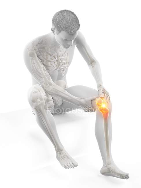 Silhouette dell'uomo seduto con dolore al ginocchio, illustrazione concettuale . — Foto stock