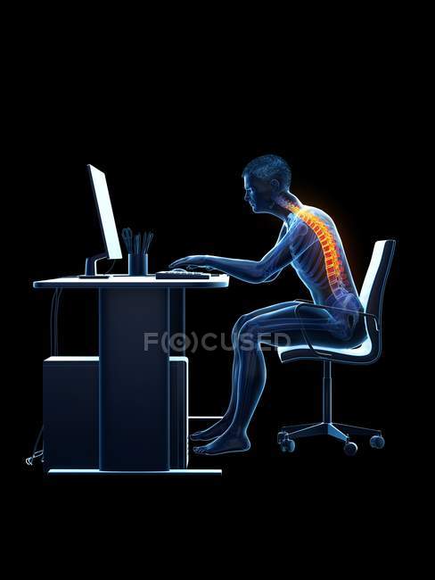 Болі в спині офісний працівник сидить і працює на столі, Концептуальна ілюстрація. — стокове фото