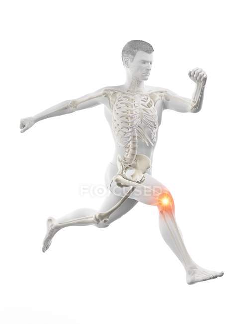 Силуэт бегуна с болью в колене, цифровая иллюстрация
. — стоковое фото