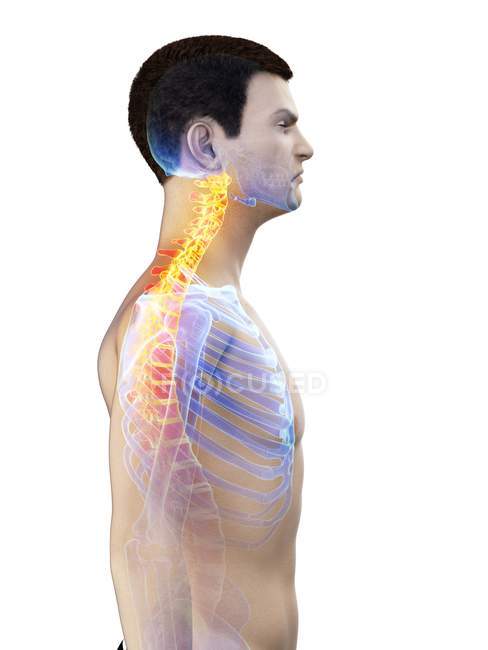 Silhouette masculine avec douleur au cou, illustration conceptuelle . — Photo de stock