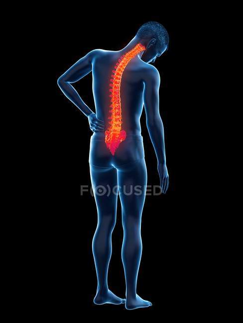Vista posteriore del corpo maschile con mal di schiena su sfondo nero, illustrazione digitale . — Foto stock