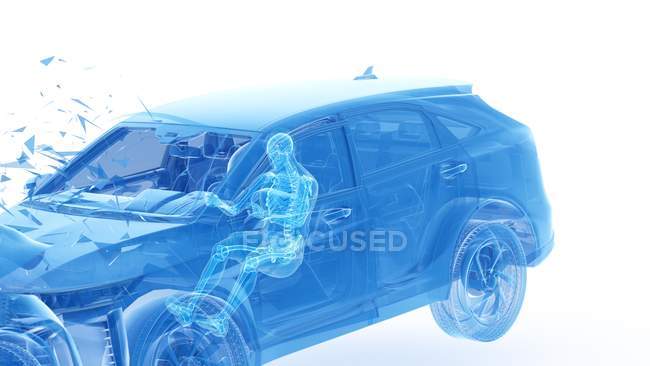 Ilustración de rayos X del riesgo de lesiones durante el choque frontal del automóvil, ilustraciones digitales . - foto de stock