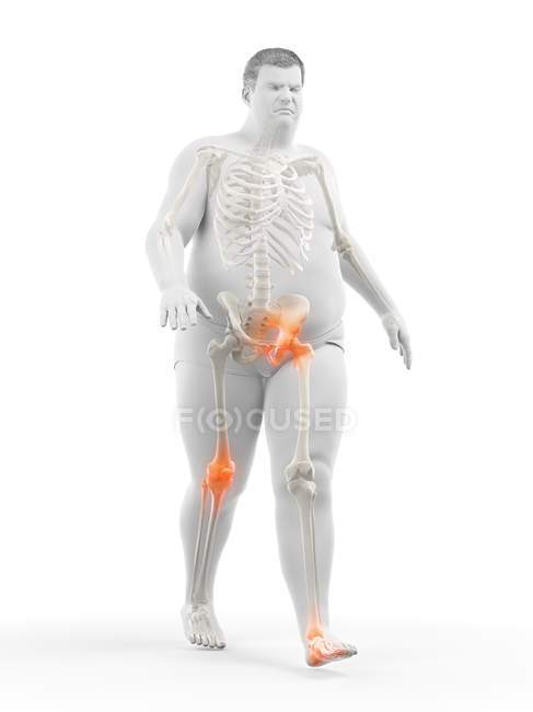 Silueta del hombre obeso que camina que tiene dolor en las articulaciones, ilustración por computadora . - foto de stock