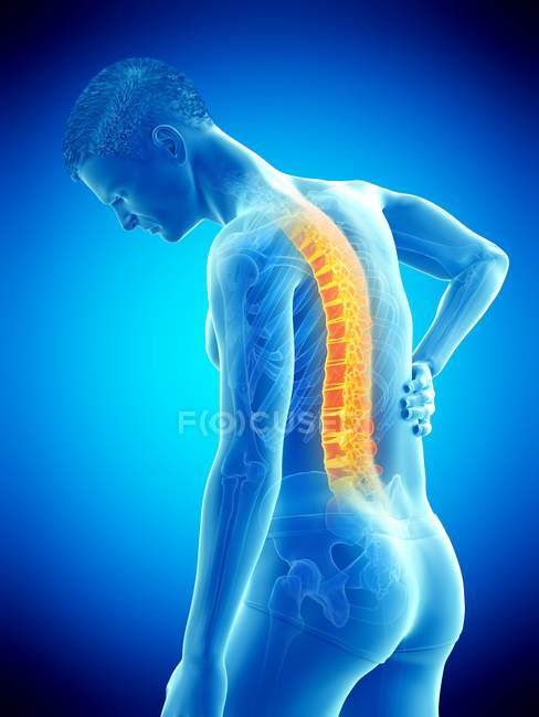 Bending male silhouette with back pain, conceptual illustration. — Stock Photo
