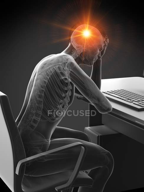 Ilustración conceptual del trabajador de oficina abstracto con dolor de cabeza en el lugar de trabajo . - foto de stock