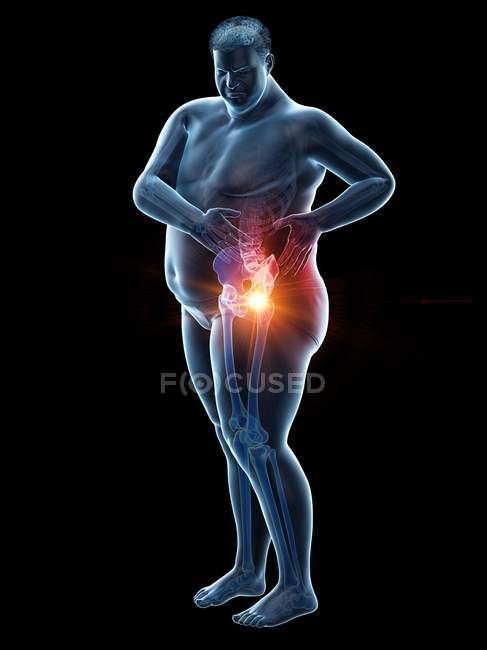 Silueta de hombre obeso con dolor de cadera, ilustración digital
. - foto de stock