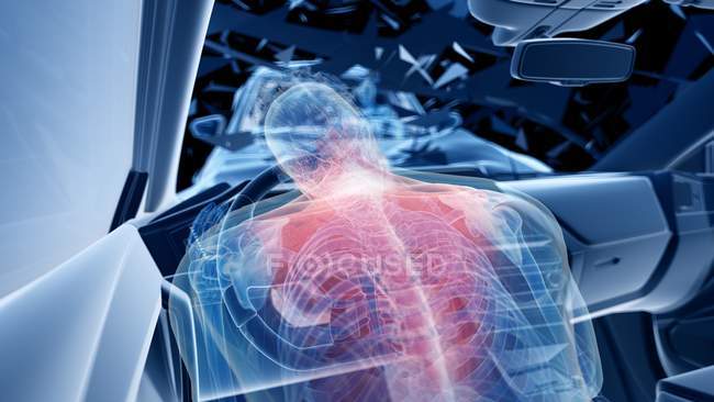Ilustración de rayos X del riesgo de lesiones en la columna vertebral durante un accidente de tráfico frontal, ilustraciones digitales . - foto de stock