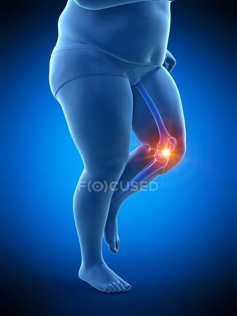 Silueta de corredor obeso masculino con dolor de rodilla, ilustración digital conceptual . - foto de stock