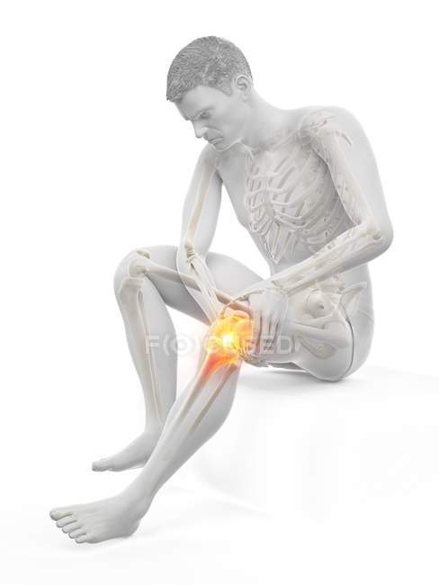 Silueta del hombre sentado con dolor de rodilla, ilustración conceptual . - foto de stock