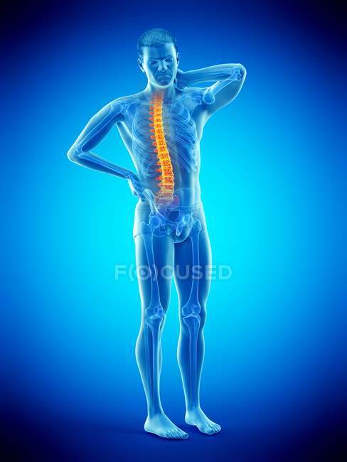 Vorderseite des männlichen Körpers mit Rückenschmerzen, konzeptionelle Illustration. — Stockfoto