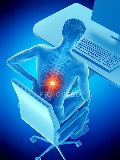 Office worker with back pain due to sitting in high angle view, digital illustration. — Stock Photo