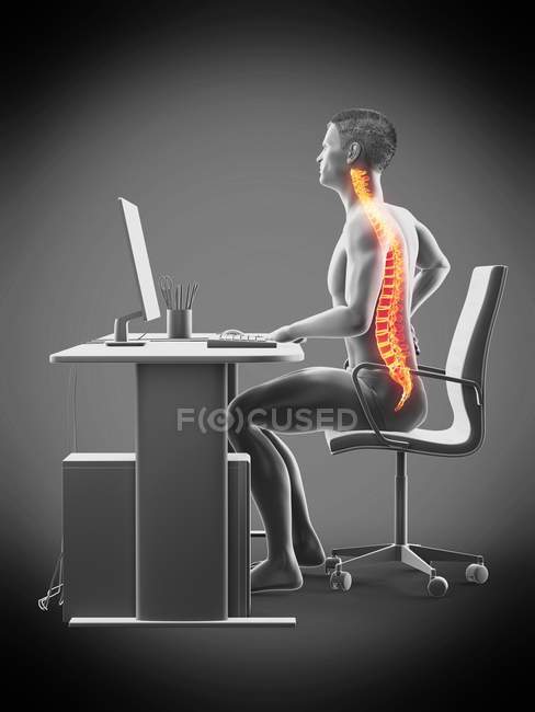 Trabalhador de escritório masculino com dor nas costas, ilustração conceitual . — Fotografia de Stock