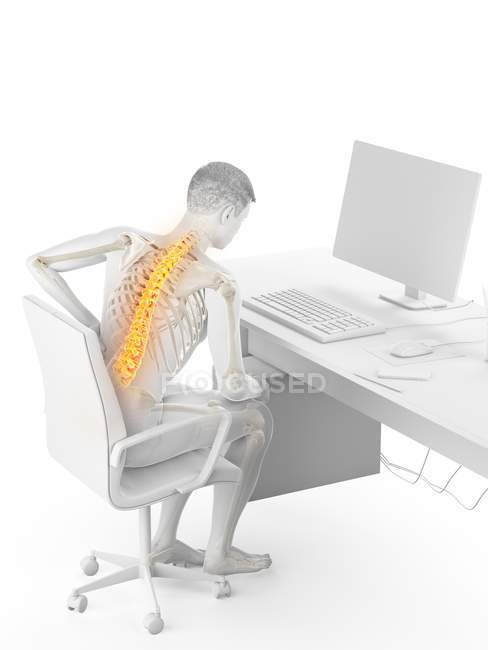 Employé de bureau masculin souffrant de maux de dos dus à la position assise, illustration conceptuelle . — Photo de stock