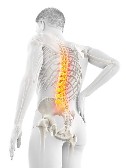 Silueta masculina con dolor de espalda en ángulo bajo, ilustración conceptual
. — Stock Photo