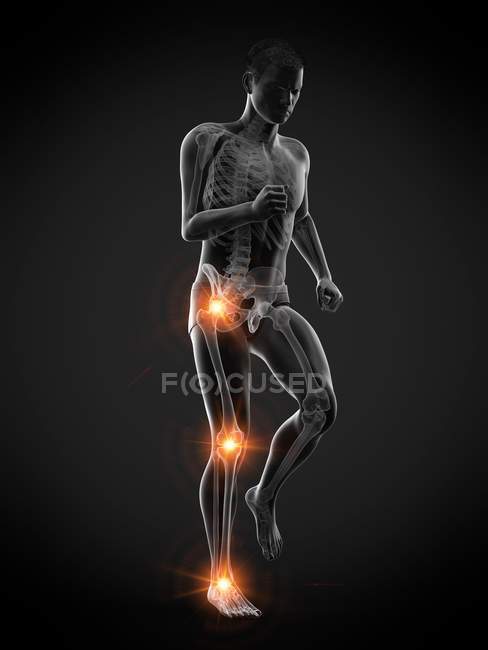 Silhueta de corredor masculino com dor nas articulações, ilustração conceitual
. — Fotografia de Stock