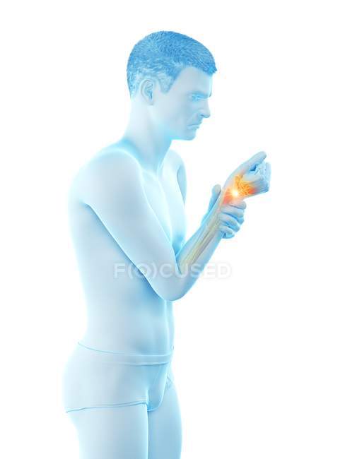 Abstrakter Männerkörper mit Schmerzen am Handgelenk, konzeptionelle Illustration. — Stockfoto