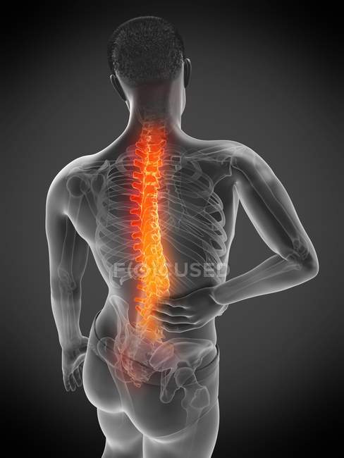 Мужское тело с болью в спине под высоким углом обзора, концептуальная иллюстрация . — стоковое фото
