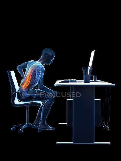 Vista lateral do trabalhador de escritório com dor nas costas devido a sentar na mesa, ilustração conceitual . — Fotografia de Stock