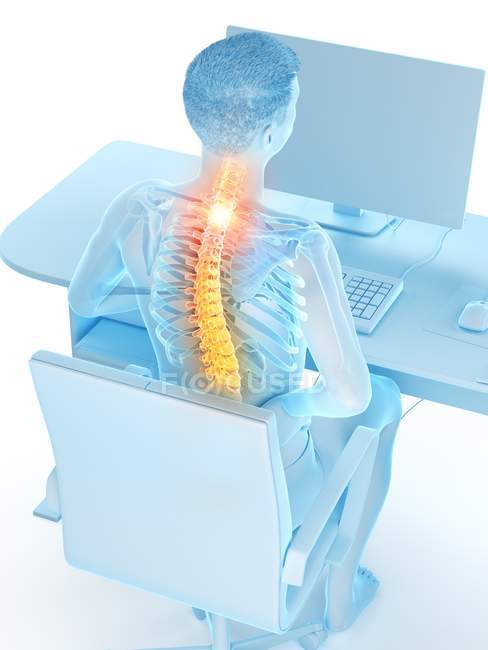 Office worker with back pain in high angle view, conceptual illustration. — Stock Photo