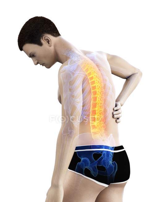 Flexión silueta masculina con dolor de espalda, ilustración conceptual
. — Stock Photo