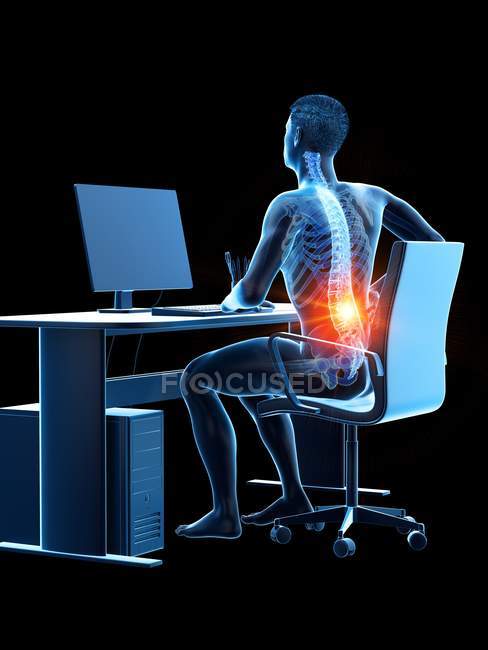 Male office worker with back pain, conceptual illustration. — sore ...